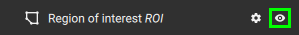 ROI_eye_1.79